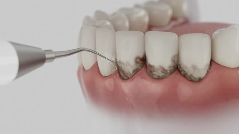 Trusted Invisalign Clear Aligners service in Brighton, IL - Dentist Open Now